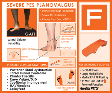 The QUADRASTEP SYSTEM®